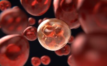 Hallazgos provisionales positivos de ensayo inicial para anemia de células falciformes