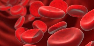 Asociación civil de pacientes con hemoglobinuria paroxistica nocturna