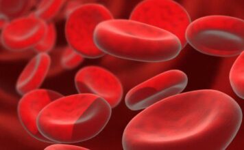 Asociación civil de pacientes con hemoglobinuria paroxistica nocturna