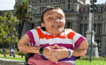 La historia de “Capocha”, el joven con los huesos de cristal que suma títulos universitarios