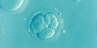 Los investigadores encuentran signos de la enfermedad de Huntington en el desarrollo embrionario