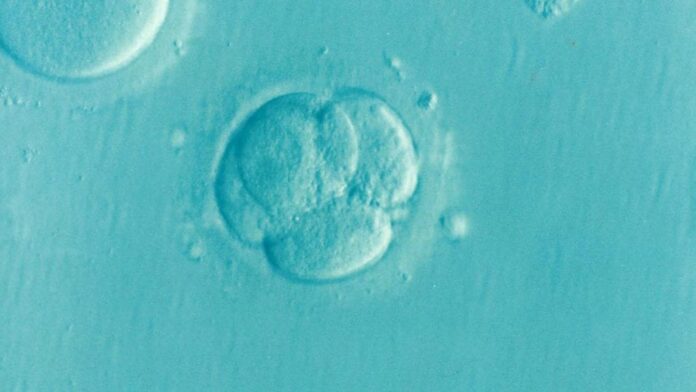 Los investigadores encuentran signos de la enfermedad de Huntington en el desarrollo embrionario
